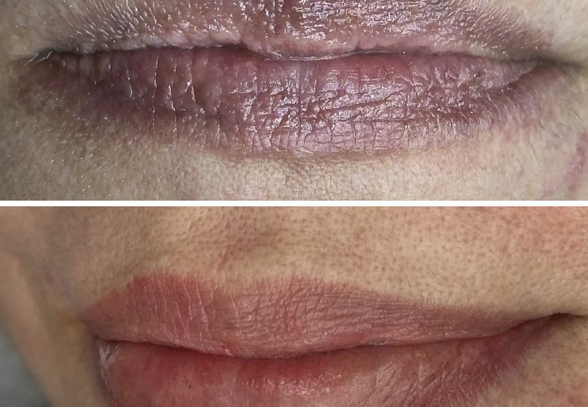 Resultado del tratamiento hidratante Nano Lips